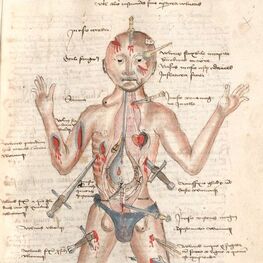 Medieval illuminated image of a man's body with knives stuck in to various places and types of wounds labeled
